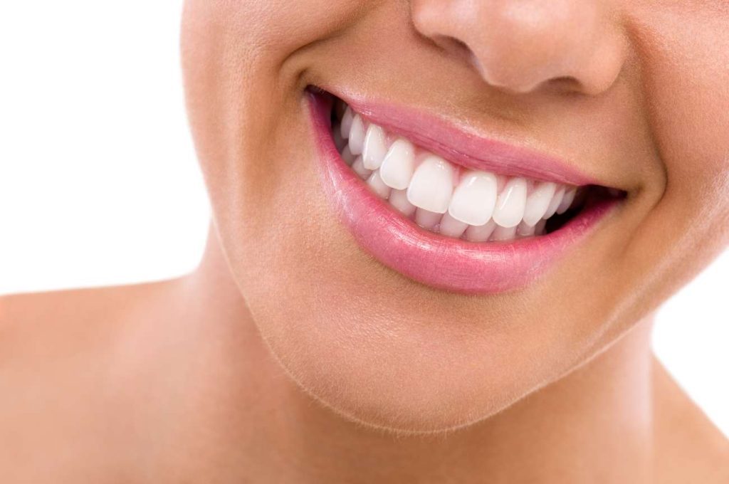 Meglio faccette dentali o sbiancamento?