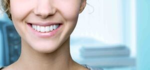 Posso fare lo sbiancamento con gli impianti dentali
