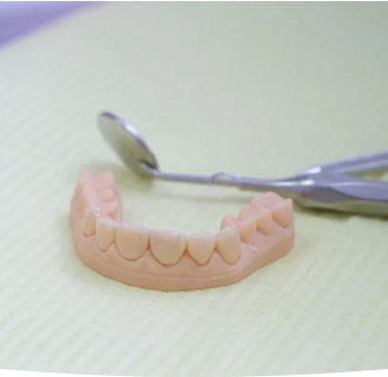 Tornare a sorridere con faccette dentali