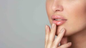Complicazioni dopo il filler labbra